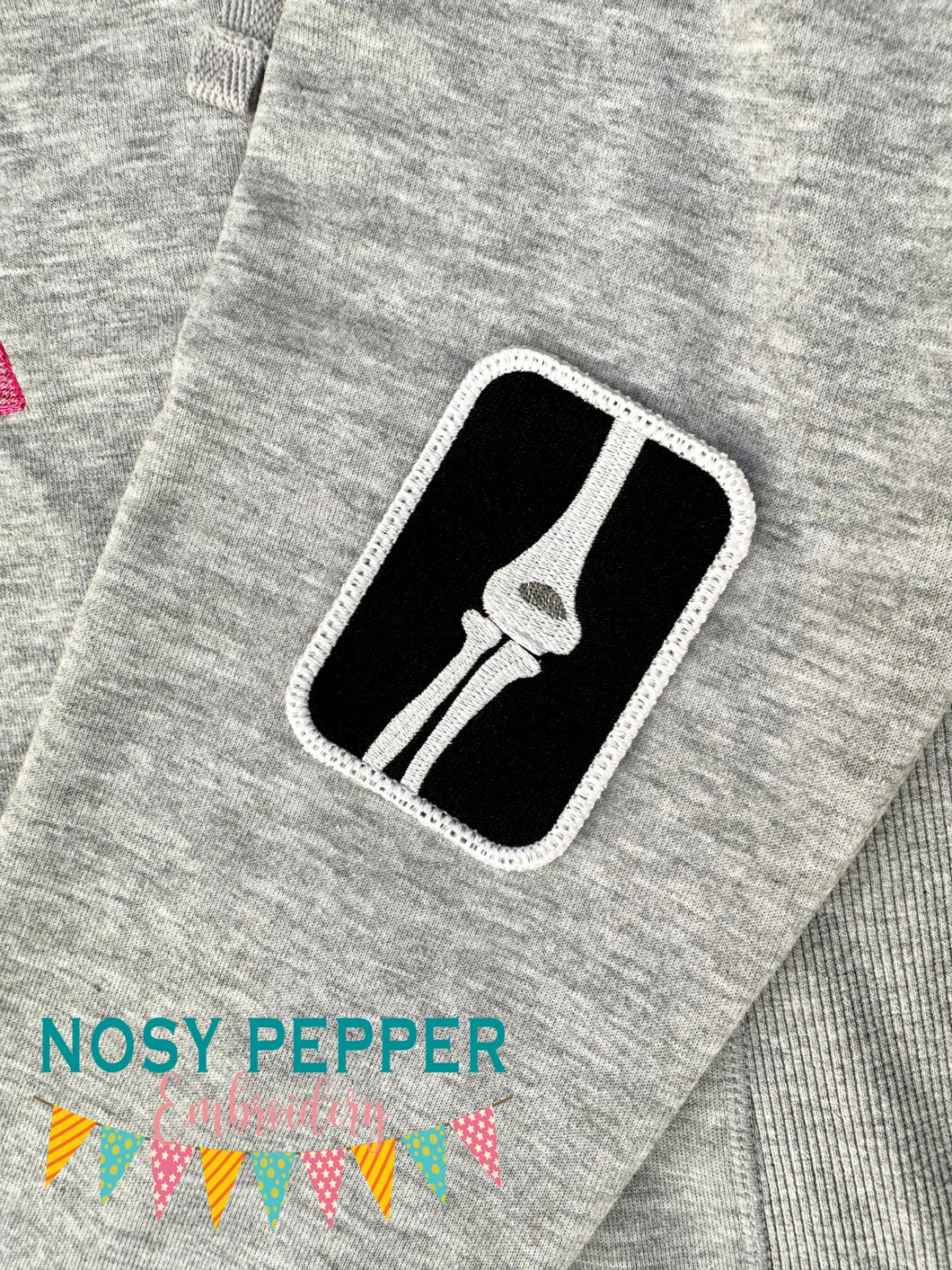 Elbow X-Ray patch machine embroidery design (2 sizes included) DIGITAL DOWNLOAD